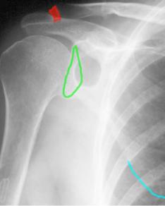 topic1image6