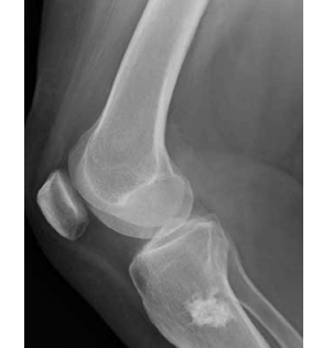 topic2image1