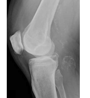 topic2image3