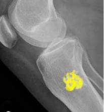 topic2image4