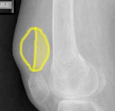 topic2image5