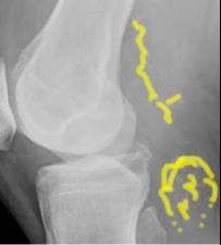 topic2image6