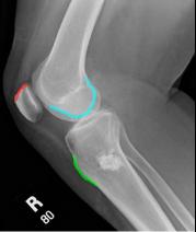 topic2image7