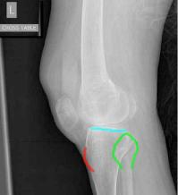 topic2image8