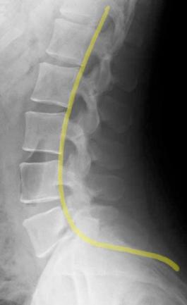 topic3image12