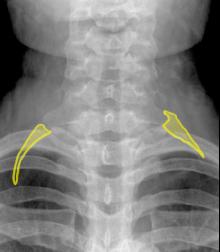 topic3image4