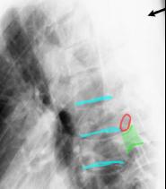 topic3image8