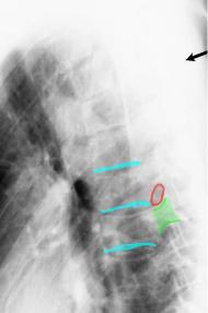 topic3image8