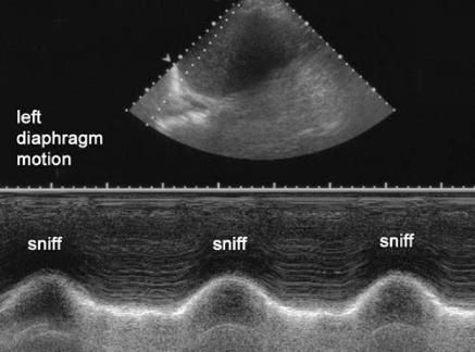 ltdiaphmotion1