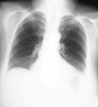 case1image1