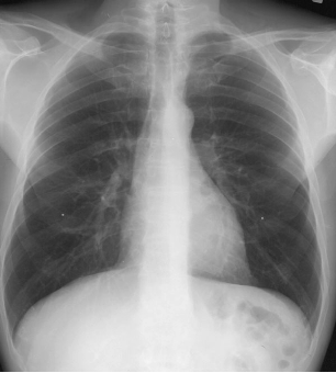 case1image2