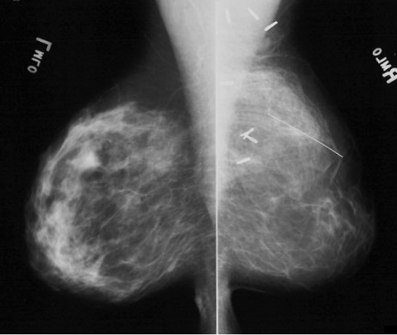 case3image1