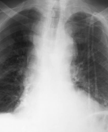 case1image1