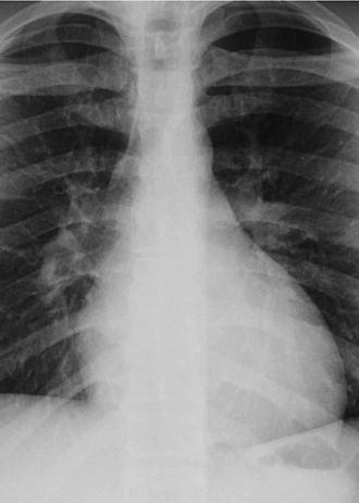 case1image2