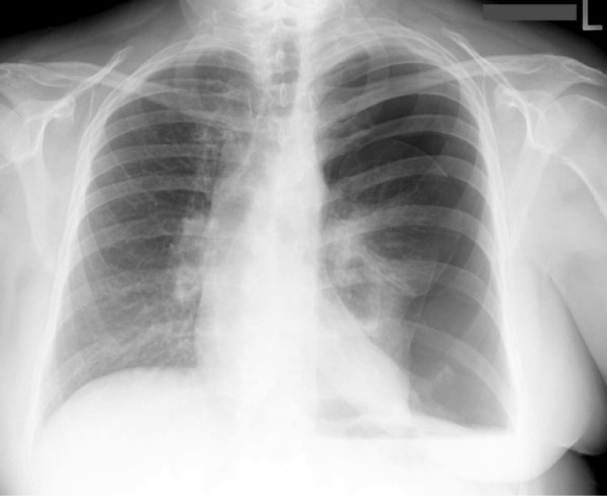case2image1