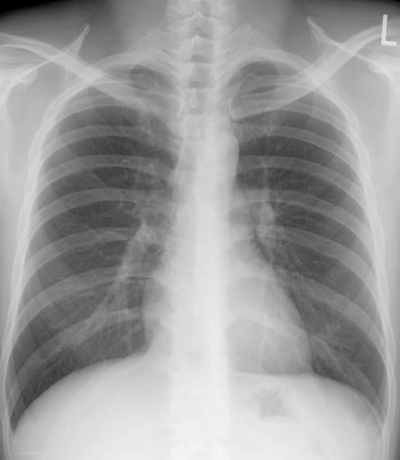 case2image2