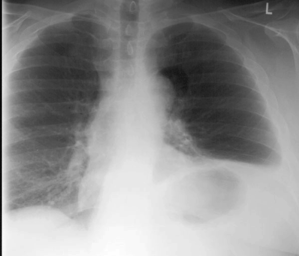 case3image1