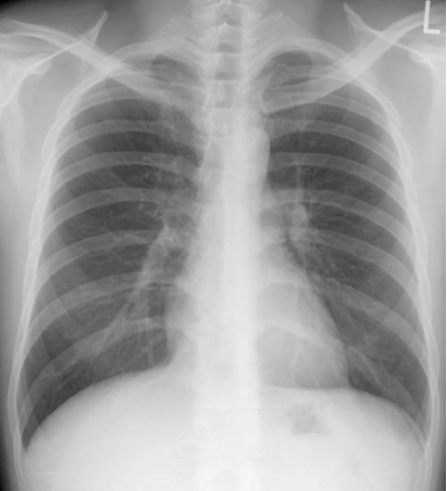 case3image2