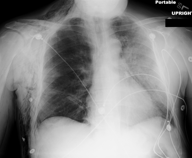 case4part1