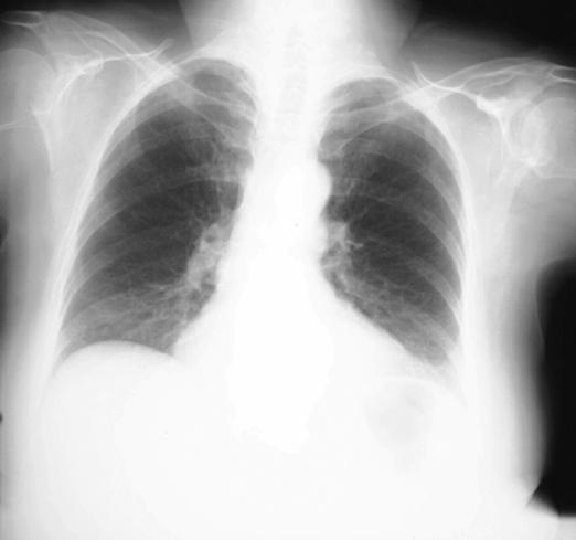 case1image1