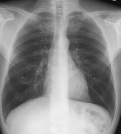 case1image2