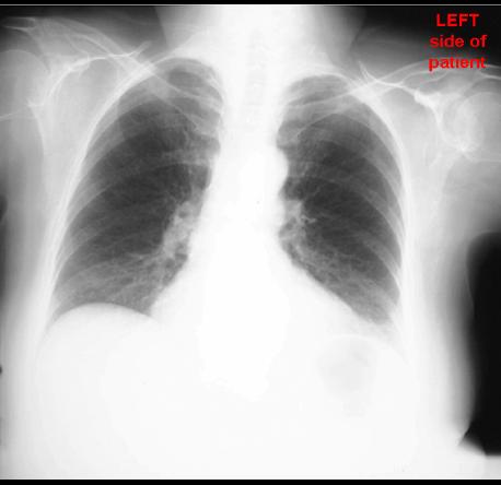 case1image3
