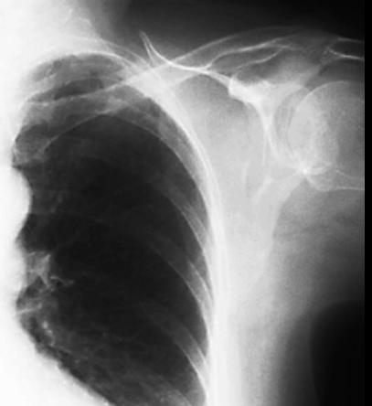 case1image4