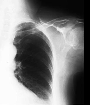 case1image4