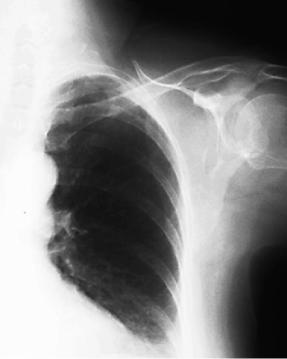 case1image4