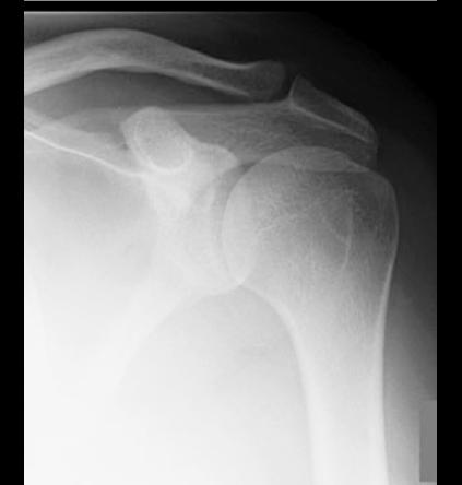 case1image5