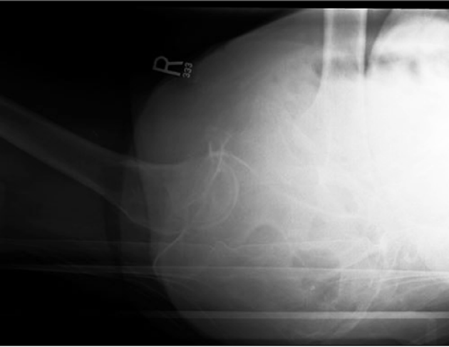 case2image2