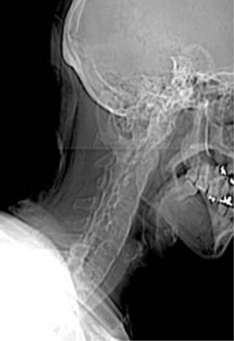 case4image1