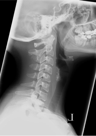 case4image2