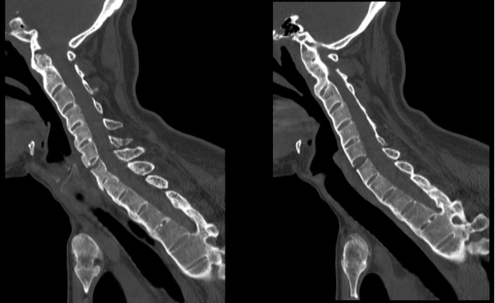case4image3