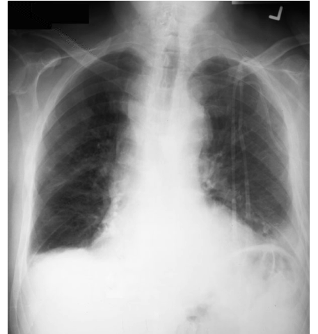 case1image12