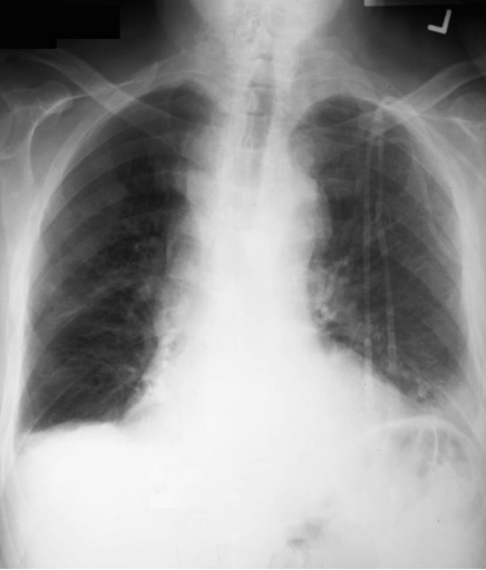 case1image1