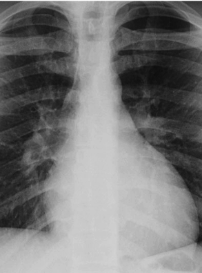 case1image2