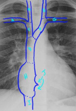 case1image3