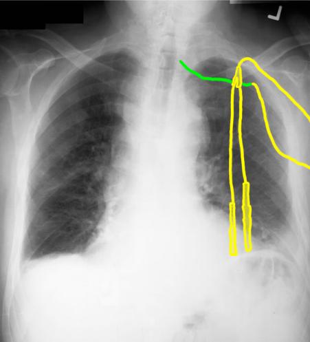 case1image5