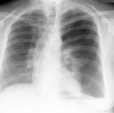 case2image1