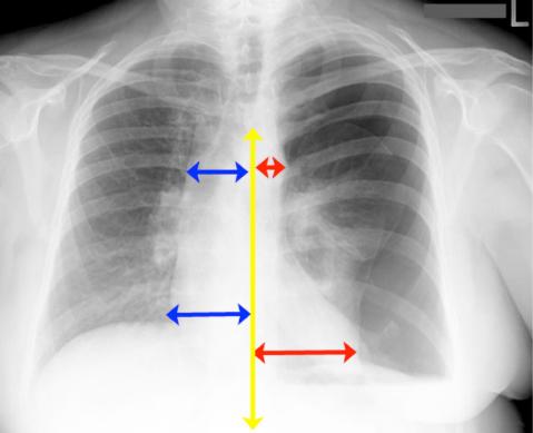 case2image3
