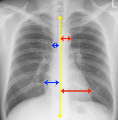 case2image4