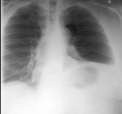 case3image1