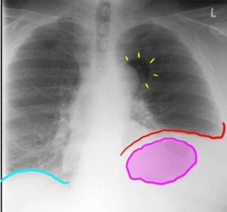case3image4