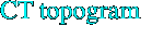 CT topogram