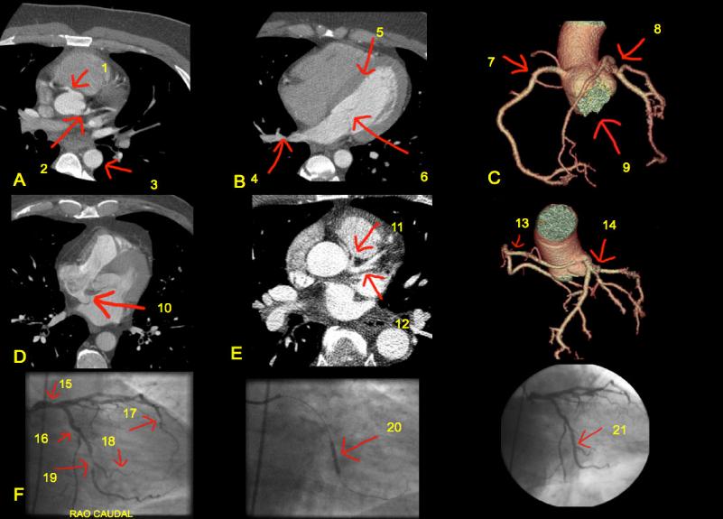 cardiacposter